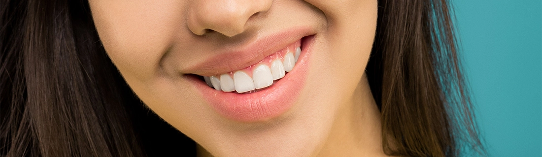 Veneers in Elmhurst IL