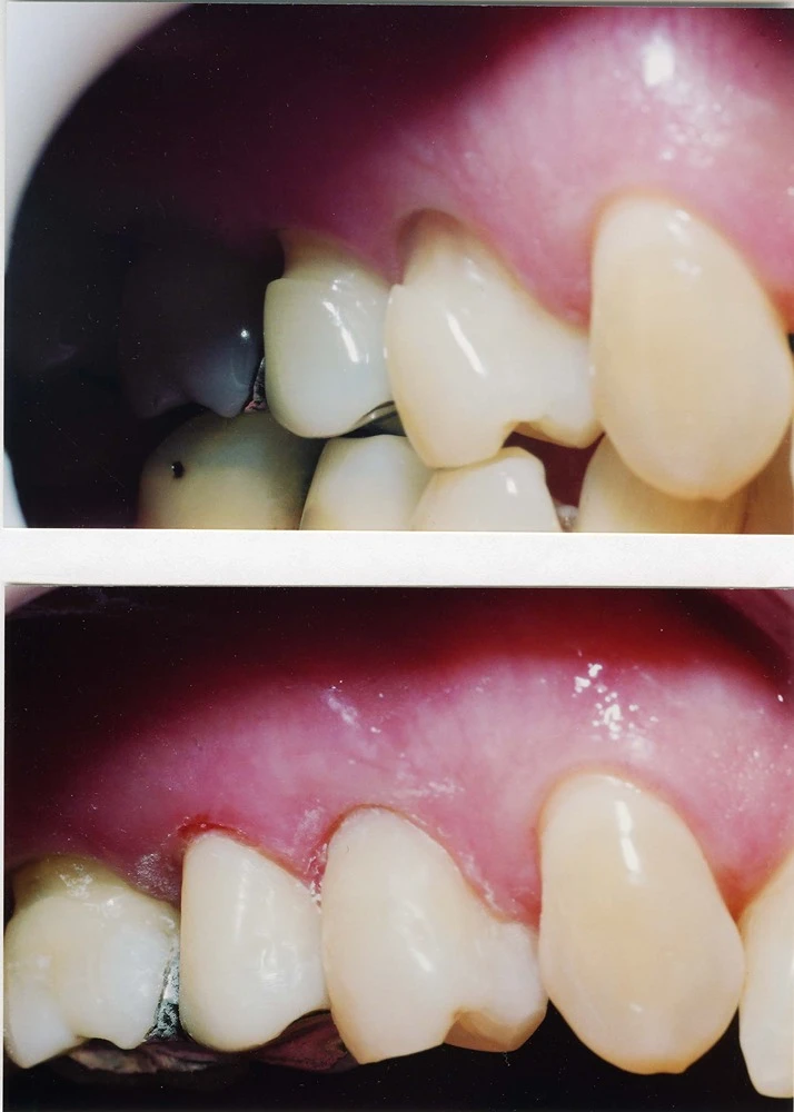 Dentist Elmhurst IL Cosmetic Dentistry
